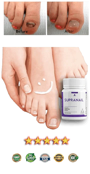 supranail official website